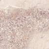 Плитка FMG Gemstone MaxFine Gem Rose Lucidato 150x150 (L150373MF6) Для кухні, Для громадських приміщень, Для житлових приміщень, Для ванної